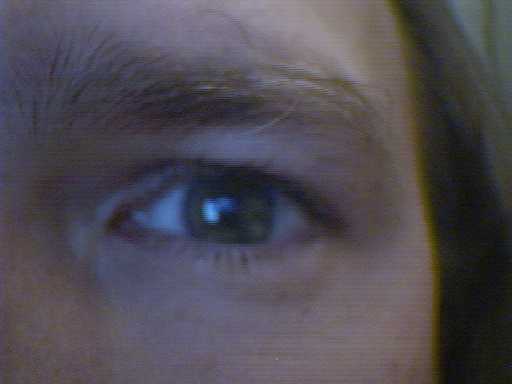 eye.JPG